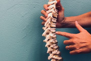 Chiropractic Treatment